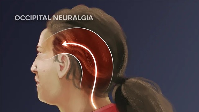 benh/dau-dau-arnold.html