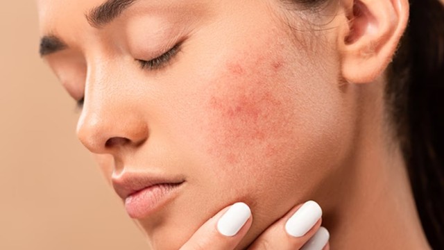 bai-viet/dau-hieu-bi-di-ung-da-mat-thoi-tiet.html