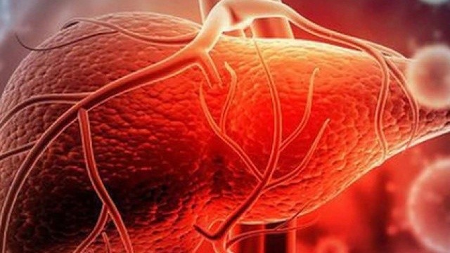 bai-viet/dau-hieu-gan-can-duoc-thai-doc-4-cach-thai-doc-gan-hieu-qua-tai-nha-55508.html