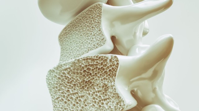 bai-viet/doc-vi-nhanh-6-dau-hieu-loang-xuong-dien-hinh-khong-nen-bo-qua.html