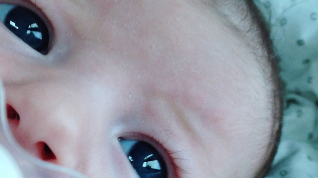 bai-viet/dau-hieu-mat-tre-so-sinh-khong-binh-thuong-bieu-hien-nhu-the-nao.html