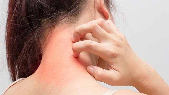 bai-viet/dau-hieu-nhan-biet-ban-bi-benh-me-day-anh-sang-mat-troi.html