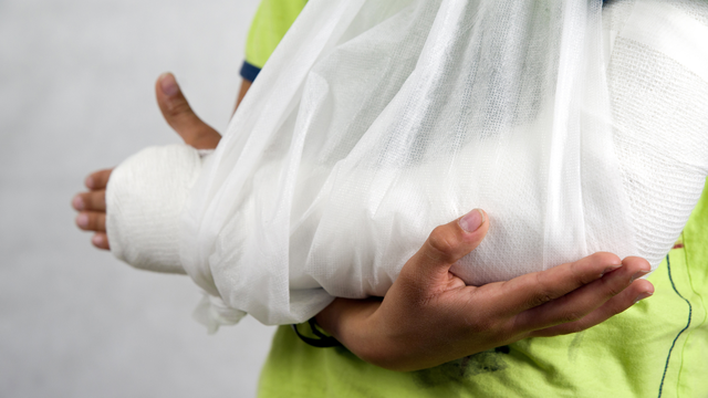 bai-viet/dau-hieu-nhan-biet-dieu-tri-va-thoi-gian-hoi-phuc-chan-thuong-gay-2-xuong-cang-tay.html