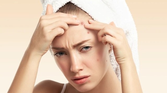 bai-viet/dau-hieu-nhan-biet-mun-mach-luon-tren-da.html