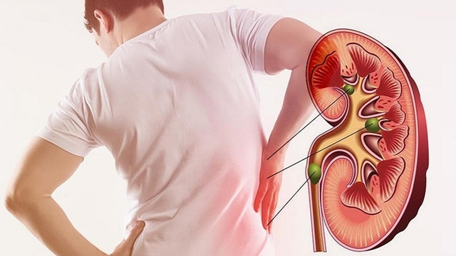 bai-viet/dau-hieu-than-yeu-o-nam-gioi-va-nhung-nguyen-nhan-gay-benh-can-biet-69874.html