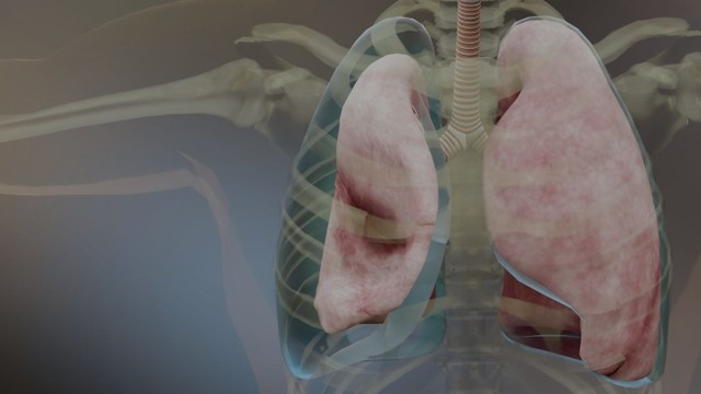 bai-viet/tong-hop-cac-dau-hieu-tran-dich-mang-phoi-ban-khong-nen-bo-qua.html