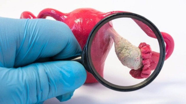 bai-viet/dau-hieu-u-nang-buong-trung-va-cac-phuong-phap-dieu-tri-pho-bien-hien-nay.html