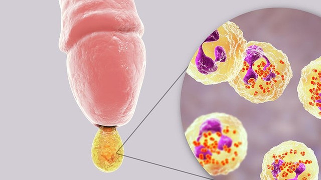 bai-viet/dau-hieu-ung-thu-duong-vat-nhung-trieu-chung-ban-khong-nen-bo-qua.html