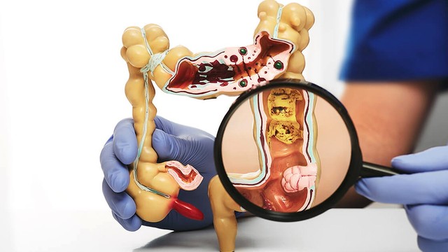 bai-viet/dau-hieu-ung-thu-truc-trang-can-biet-de-bao-ve-suc-khoe.html