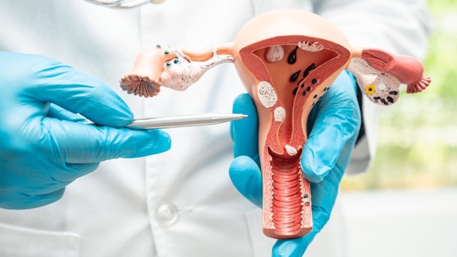 bai-viet/dau-hieu-viem-co-tu-cung-la-gi-nguyen-nhan-dieu-tri-va-cach-phong-tranh-viem-co-tu-cung.html