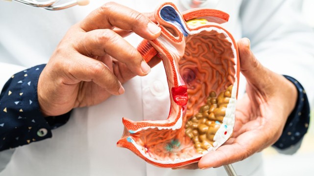 bai-viet/dau-hieu-xuat-huyet-tieu-hoa-la-gi-lam-gi-khi-xuat-huyet-tieu-hoa.html