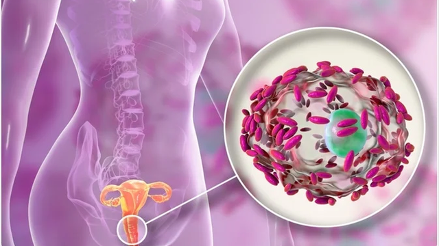 bai-viet/dau-lung-dau-bung-duoi-ra-khi-hu-la-trieu-chung-cua-benh-gi.html