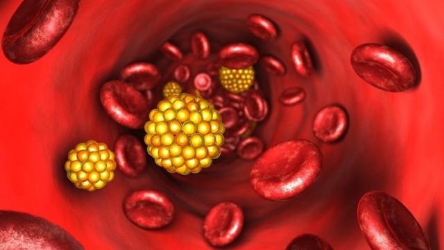 bai-viet/dau-toi-tue-linh-co-tac-dung-gi-voi-nguoi-bi-mo-mau-cao-61005.html