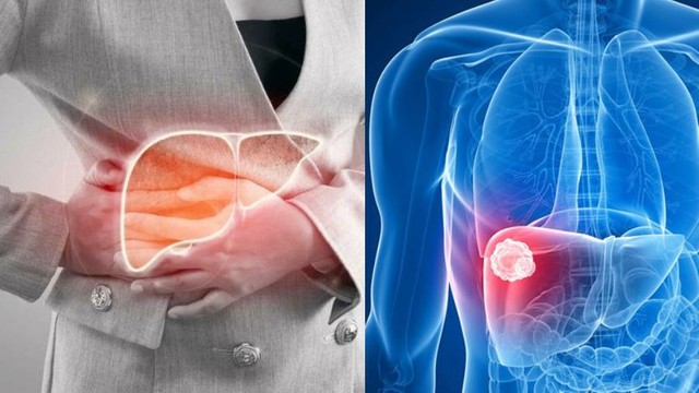 bai-viet/dau-tuc-ha-suon-phai-va-su-canh-bao-ve-cac-benh-ly-nguy-hiem.html