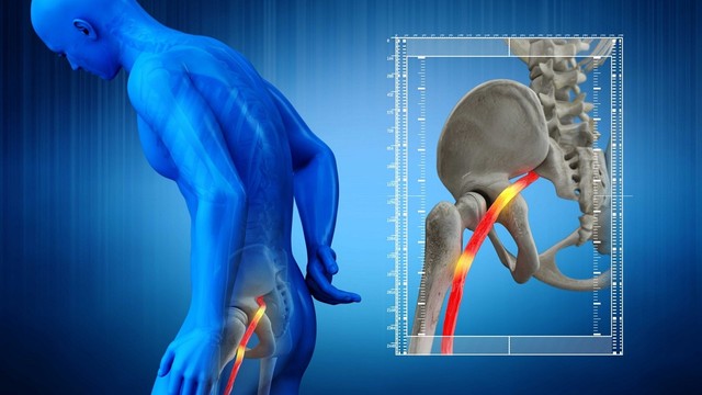 bai-viet/day-than-kinh-toa-nam-o-dau-benh-thuong-gap-ve-day-than-kinh-toa.html