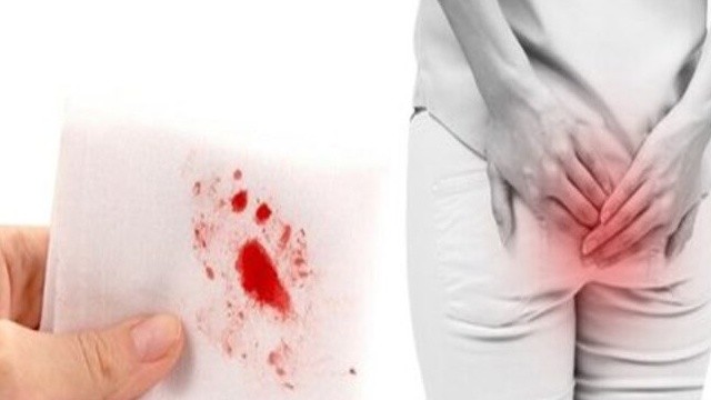 bai-viet/di-ngoai-ra-mau-nen-an-gi-de-benh-nhanh-chong-cai-thien.html