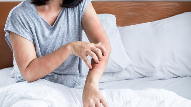 bai-viet/di-ung-allopurinol-nguyen-nhan-trieu-chung-va-cach-dieu-tri.html