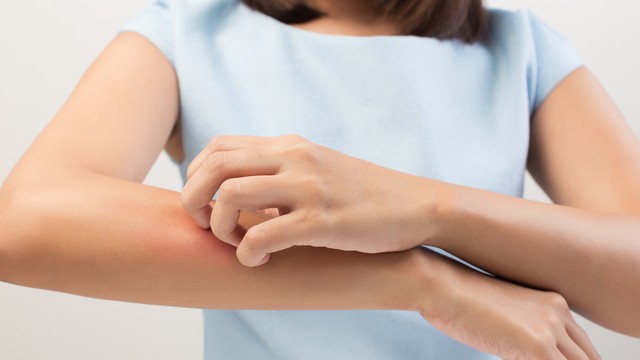 bai-viet/di-ung-la-gi-cac-kieu-di-ung-pho-bien-59849.html