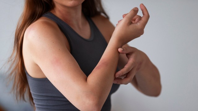 bai-viet/di-ung-niken-la-gi-cach-chan-doan-va-dieu-tri.html