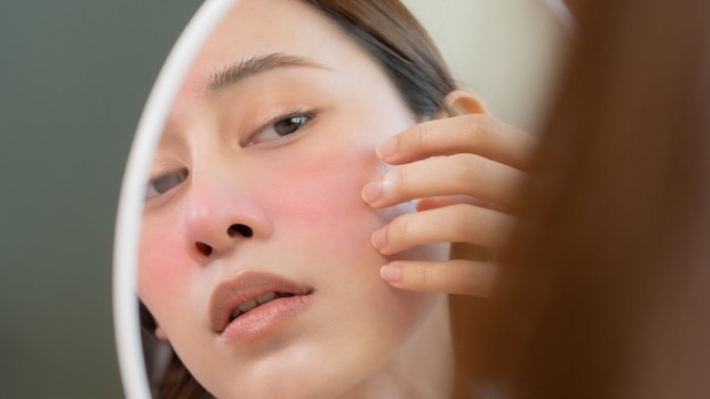 bai-viet/di-ung-thoi-tiet-o-mat-nguyen-nhan-trieu-chung-va-cach-dieu-tri.html