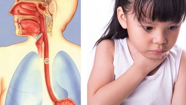 bai-viet/di-vat-duong-tieu-hoa-co-nguy-hiem-khong-nguyen-nhan-va-cach-xu-tri.html