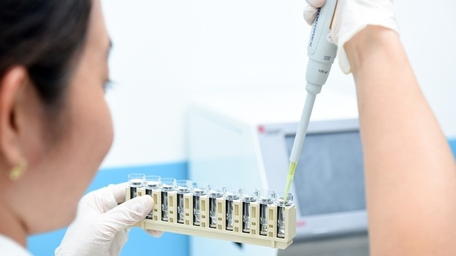 bai-viet/dien-giai-do-la-gi-vi-sao-can-phai-xet-nghiem-dien-giai-do.html