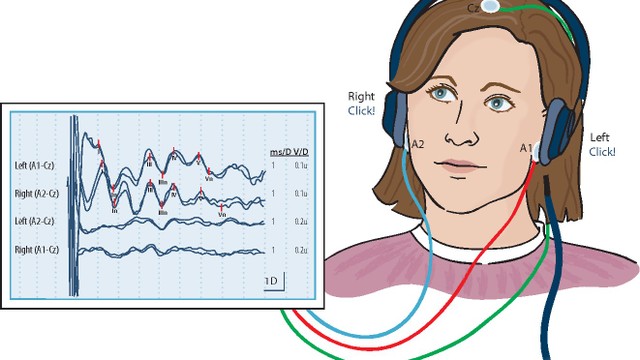 bai-viet/dien-the-goi-la-gi-ung-dung-cua-dien-the-goi-thi-giac.html