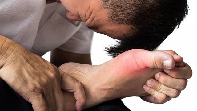 bai-viet/dieu-tri-benh-gut-hieu-qua-15447.html