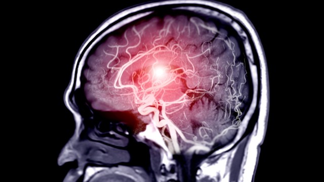 bai-viet/cac-phuong-phap-dieu-tri-tang-ap-luc-noi-so-va-cach-cham-soc-sau-dieu-tri.html