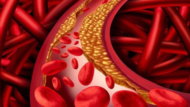 bai-viet/dieu-tri-va-phong-ngua-mau-nhiem-mo-nhung-dieu-ban-can-biet-72669.html