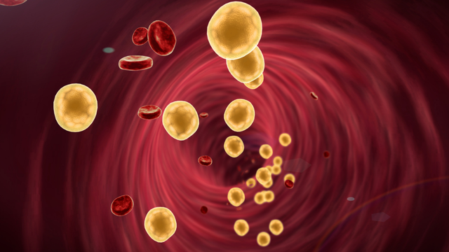 bai-viet/dinh-luong-cholesterol-toan-phan-la-gi-tam-quan-trong-cua-xet-nghiem-cholesterol-toan-phan.html