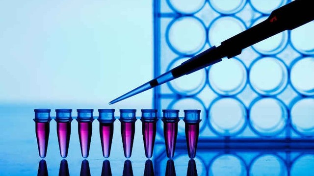 bai-viet/do-tai-luong-virus-viem-gan-c-la-gi-phuong-phap-do-tai-luong-virus-viem-gan-c.html