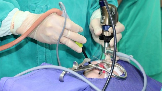 bai-viet/dot-cuon-mui-bang-song-cao-tan-khai-niem-phuong-phap-doi-tuong-va-luu-y.html