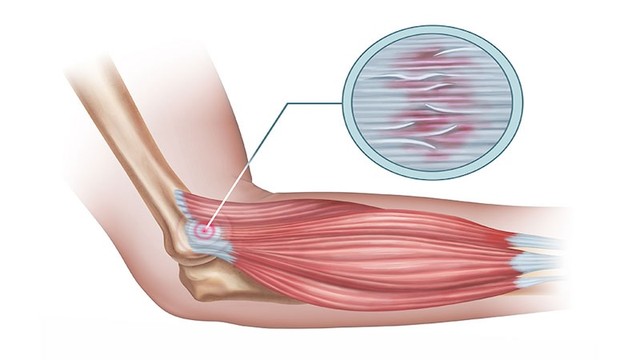 bai-viet/dut-day-chang-ben-trong-co-nguy-hiem-khong-nhung-thong-tin-can-biet.html