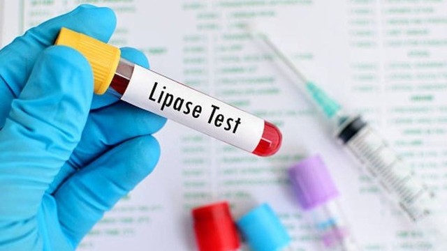 bai-viet/enzyme-lipase-la-gi-muc-dich-va-y-nghia-thuc-hien-xet-nghiem-lipase.html