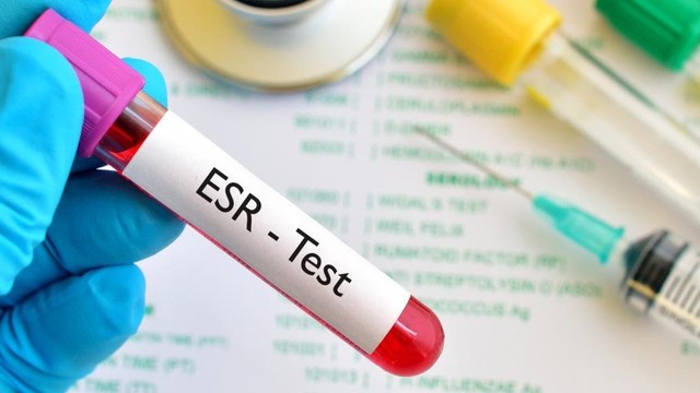 bai-viet/esr-la-gi-y-nghia-cua-xet-nghiem-esr.html