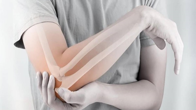 bai-viet/gay-1-3-duoi-xuong-cang-tay-nguyen-nhan-dau-hieu-cach-dieu-tri-va-bien-chung.html