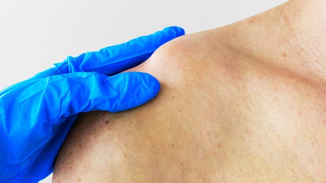 bai-viet/gay-xuong-don-co-da-bong-duoc-khong-khi-nao-co-the-tro-lai-da-bong.html