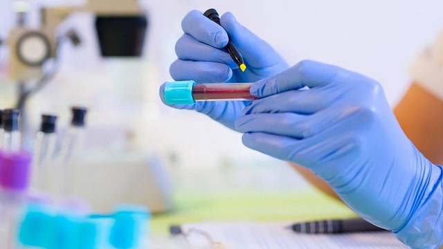 bai-viet/ggt-trong-xet-nghiem-mau-la-gi-64158.html