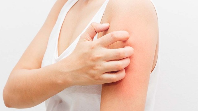 bai-viet/ghe-nuoc-o-tay-nguyen-nhan-trieu-chung-va-phuong-phap-dieu-tri.html