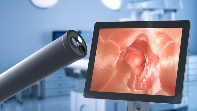 bai-viet/gia-noi-soi-da-day-dai-trang-benh-vien-dai-hoc-y-ha-noi-la-bao-nhieu.html