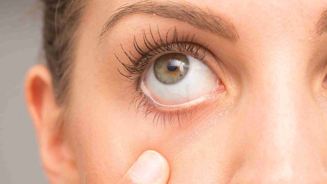 bai-viet/giac-mac-kho-nguyen-nhan-dau-hieu-nhan-biet-va-cach-de-phong-benh.html