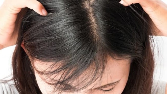 bai-viet/giai-cuu-toc-kho-co-gau-trong-thoi-tiet-hanh-kho-cuc-hieu-qua-50859.html