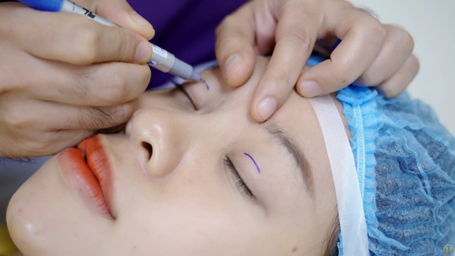 bai-viet/giai-dap-thac-mac-bi-can-co-cat-mi-duoc-khong.html