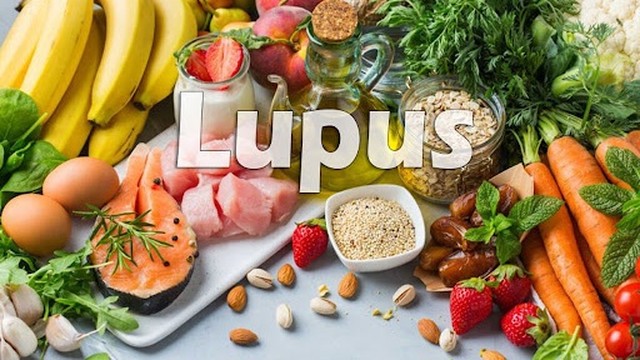 bai-viet/giai-dap-thac-mac-lupus-ban-do-nen-an-gi-55770.html
