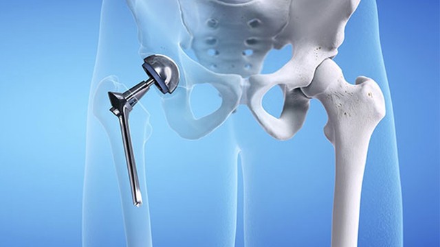 bai-viet/giai-dap-thac-mac-thay-khop-hang-bao-hiem-chi-tra-bao-nhieu.html