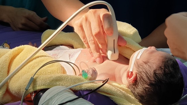 bai-viet/giai-dap-thac-mac-thong-lien-that-phan-mang-6mm-co-nguy-hiem-khong.html