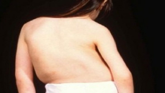 bai-viet/cong-veo-cot-song-bam-sinh-nguyen-nhan-trieu-chung-va-cach-dieu-tri.html