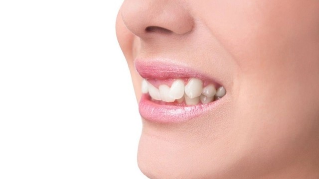 bai-viet/giai-thich-y-nghia-ten-goi-rang-9630.html