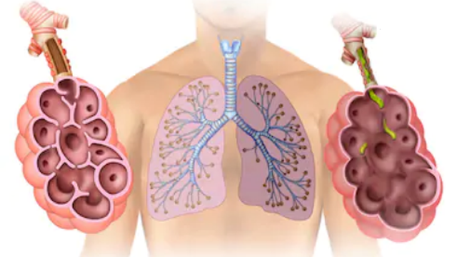 bai-viet/gian-phe-nang-nguyen-nhan-trieu-chung-chan-doan-va-dieu-tri.html